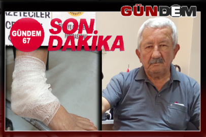 Sokak köpeğinin saldırısına uğradı!