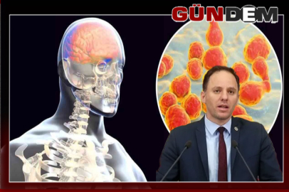 Zonguldak’ta menenjit alarmı; CHP’li Yavuzyılmaz’dan yetkililere çağrı