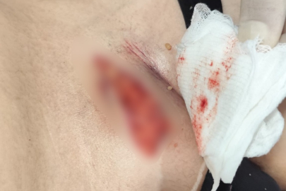 Özel hastane skandalı iddiası: “11 yaşındaki oğlumuzun sağlığıyla oynandığını düşünüyoruz”