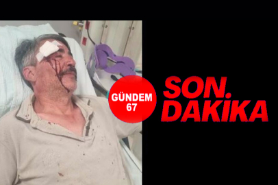 Görev Başındaki Orman Mühendisine Saldırı! Sendikadan Sert Tepki